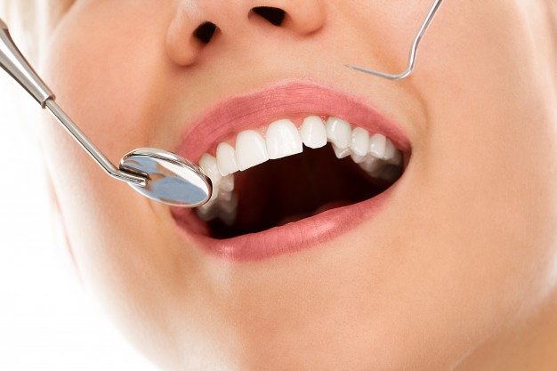 Tooth Extraction